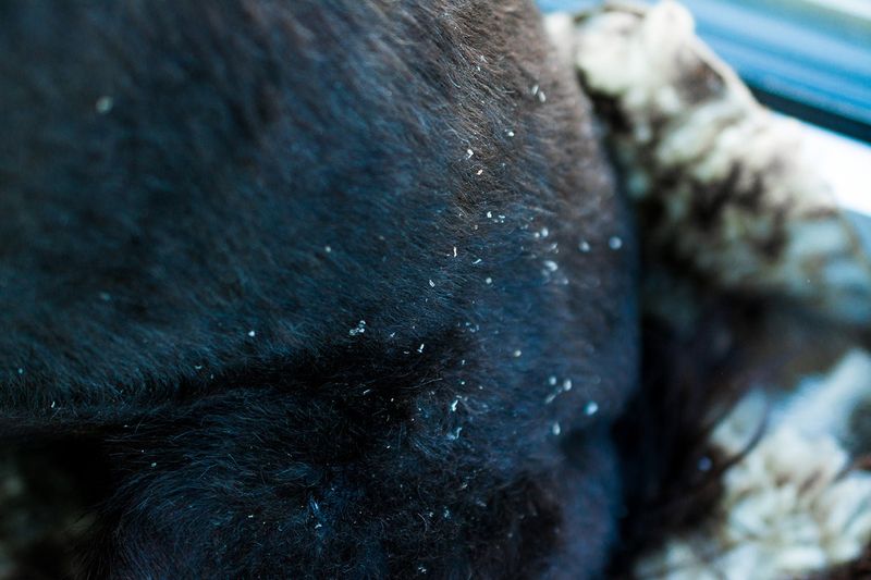 Dandruff