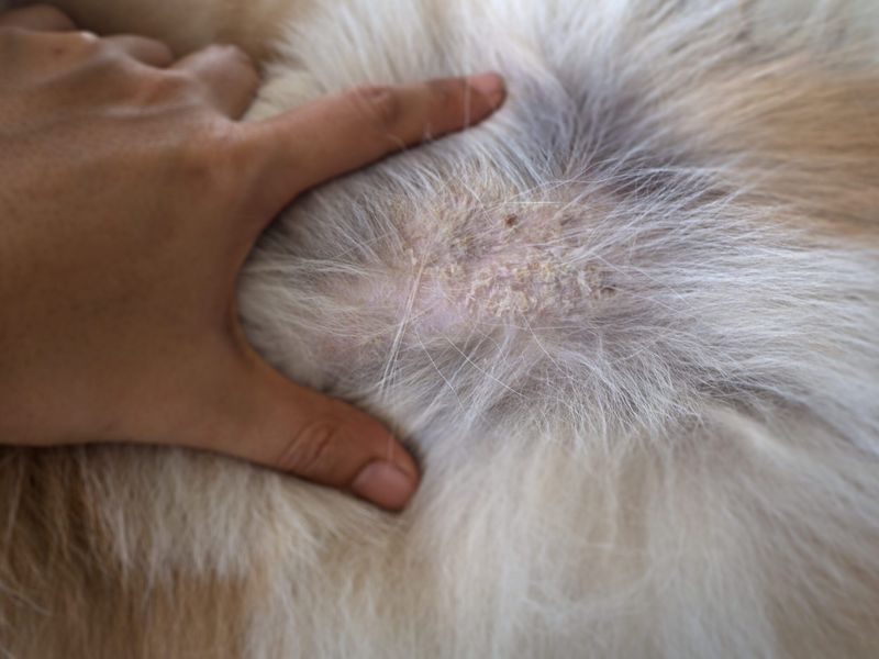 Seborrhea